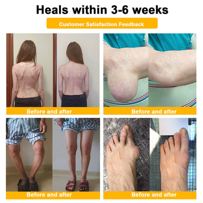 ⏰FLASH SALE: 59% OFF🔥HOOMWELL™ Botulinum Toxin & Bee Venom Pain-Relief Bone Healing Cream
