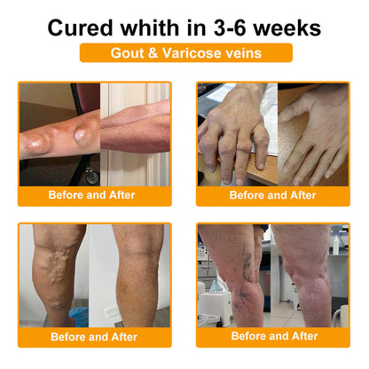 ⏰FLASH SALE: 59% OFF🔥HOOMWELL™ Botulinum Toxin & Bee Venom Pain-Relief Bone Healing Cream