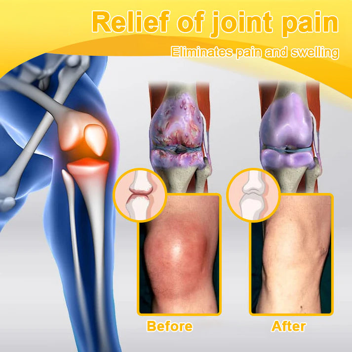 ⏰FLASH SALE: 59% OFF🔥HOOMWELL™ Botulinum Toxin & Bee Venom Pain-Relief Bone Healing Cream